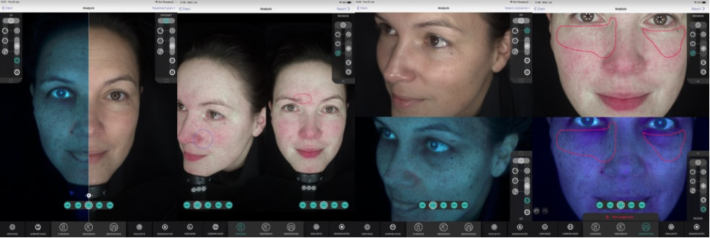 in depth skin analysis stirling