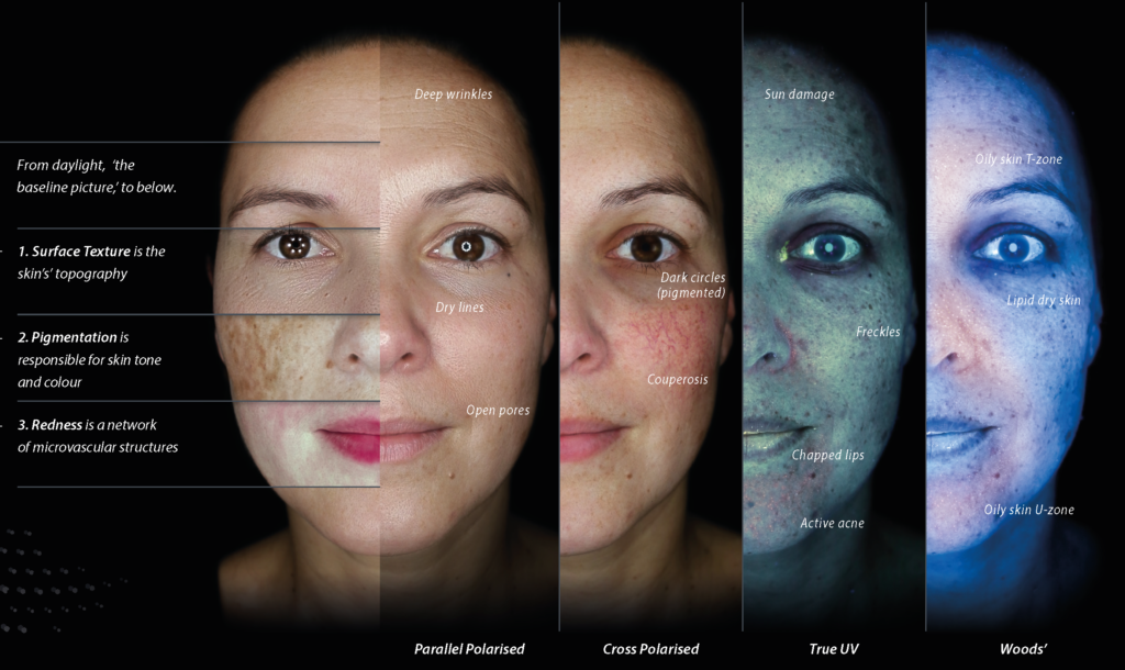 Estheva skin analysis clinic stirling