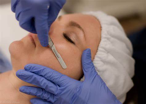 dermaplaning treatments in stirling
