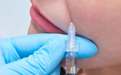 Dermal Fillers at Estheva Clinic in Stirling