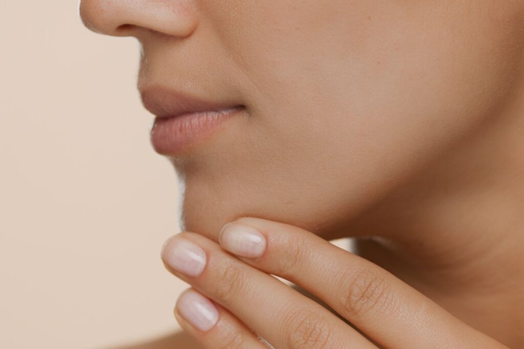 Radiesse Dermal Fillers Scotland