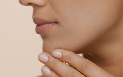 Radiesse Dermal Fillers at Estheva