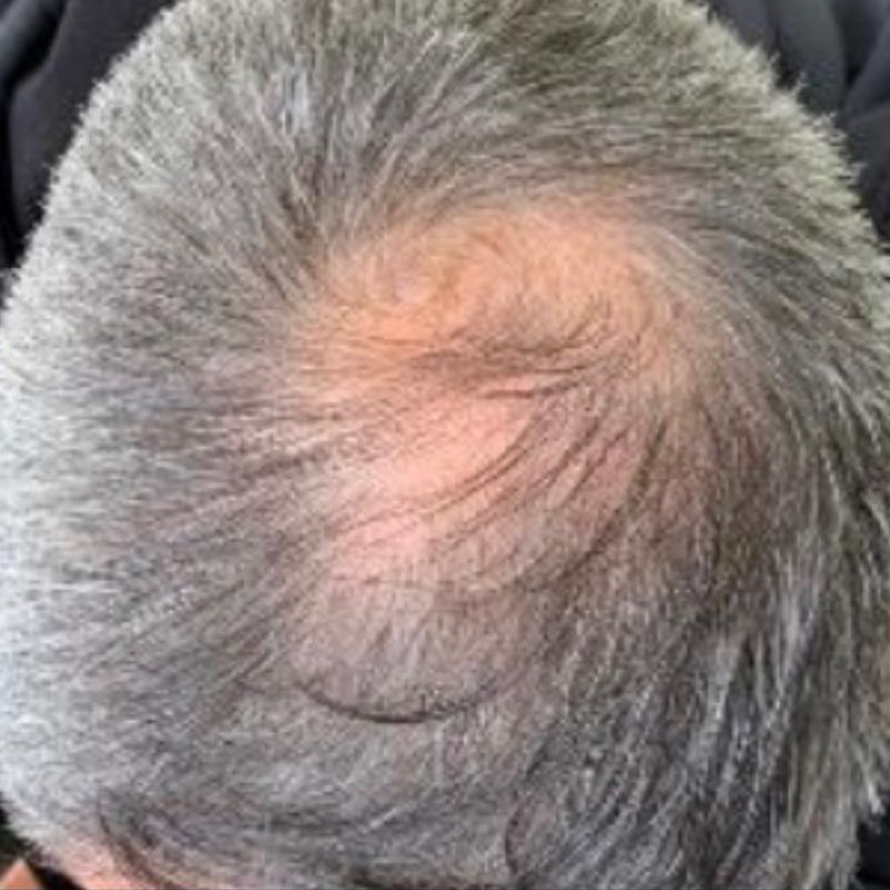 Before