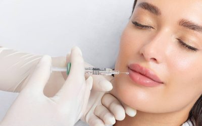Subtle Lip Enhancement with a Lip Flip