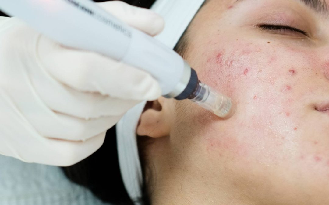 Top 10 Myths About Aesthetic Treatments