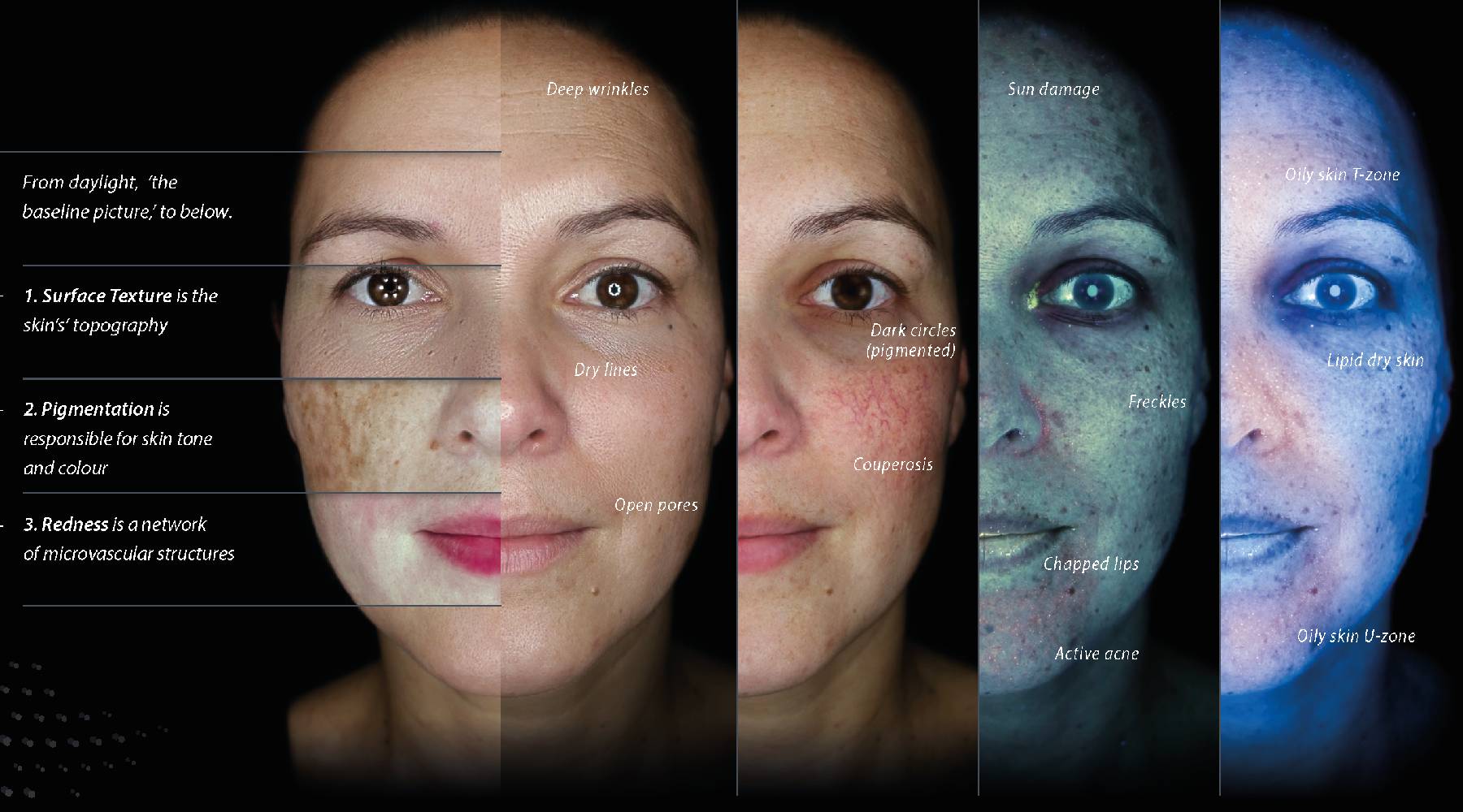 skin analysis stirling skin analysis stirling