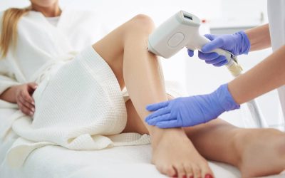 Laser Hair Removal at Estheva