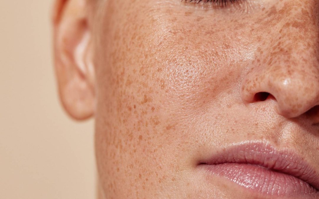 BabyGlow Treatment, For Fresh Radiant Skin