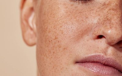 BabyGlow Treatment, For Fresh Radiant Skin